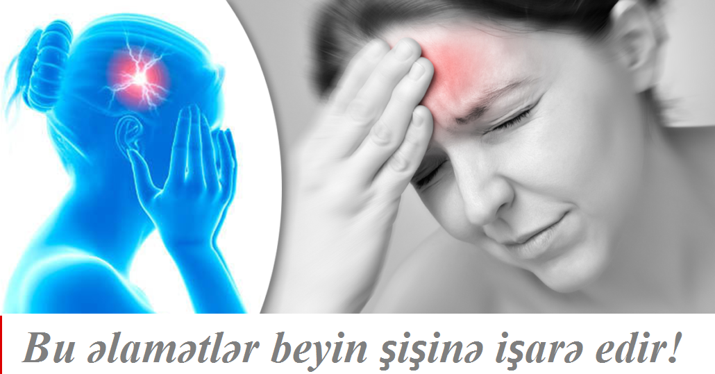 Bu əlamətlər beyin şişinə işarə edir!