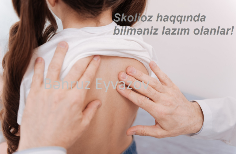 Skolioz haqqında bilməniz lazım olanlar!