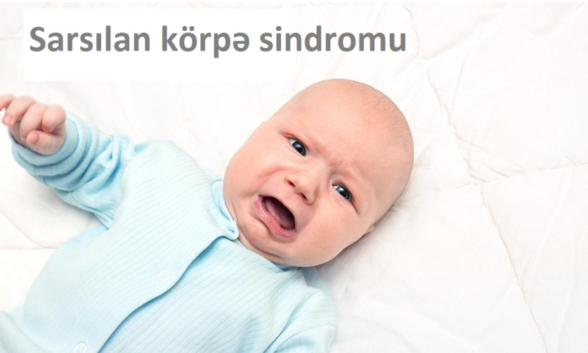 Sarsılan körpə sindromu.